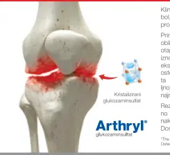 supozitorija za liječenje osteoartritisa