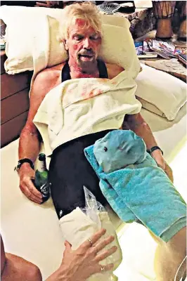  ??  ?? Richard Branson shortly after he crashed his bike on Virgin Gorda on the British Virgin Islands