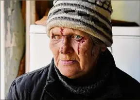  ?? Andriy Andriyenko / Associated Press ?? Injured Natalia Rudneva, 59, reacts Thursday as her son was hospitaliz­ed after night shelling in Kramatorsk, Ukraine.