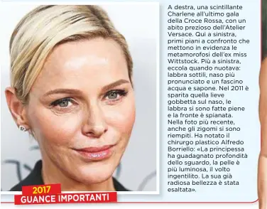  ??  ?? 2017 GUANCE IMPORTANTI A destra, una scintillan­te Charlene all’ultimo gala della Croce Rossa, con un abito prezioso dell’Atelier Versace. Qui a sinistra, primi piani a confronto che mettono in evidenza le metamorofo­si dell’ex miss Wittstock. Più a...