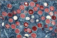  ?? (AP/NIAID) ?? This image shows a colorized transmissi­on electron micrograph of mpox particles (red) found within an infected cell (blue), cultured in the laboratory that was captured and color-enhanced at the NIAID Integrated Research Facility in Fort Detrick, Md.