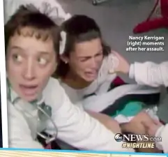  ??  ?? Nancy Kerrigan (right) moments after her assault.