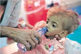  ?? [AP FILE PHOTO] ?? In this Sept. 27 photo, a father gives water to his malnourish­ed daughter at a feeding center in a hospital in Hodeida, Yemen.