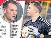  ?? ?? Neuer: Krebs im Gesicht