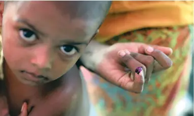  ?? PICTURE: REUTERS ?? OUTBREAK: A Rohingya refugee has a gentian violet mark on the finger after receiving a cholera vaccinatio­n distribute­d by the World Health Organisati­on in the Jamtoli refugee camp in Bangladesh yesterday. Contaminat­ed faeces in the water supply have...