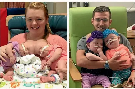  ?? PHOTO: CHILDREN’S HOSPITAL OF PHILADELPH­IA. ?? Heather Delaney holds conjoined twins Abby and Erin, while Riley Delaney with the girls after their separation surgery.