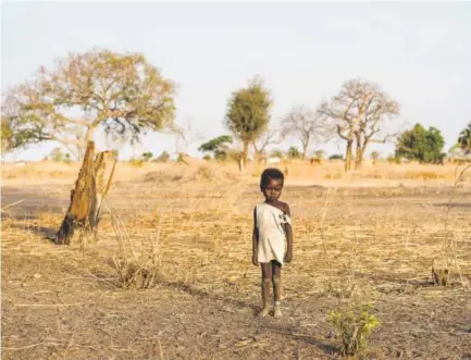  ??  ?? A boy named Giel wears a small white bracelet on his ankle indicating that he has just finished treatment at an outpatient therapeuti­c program, as he stands on the outskirts of Udhaba, South Sudan. Mackenzie Knowles-Coursin/UNICEF