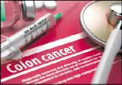  ?? FOTOLIA ?? Colorectal cancer, a malignancy that occurs in the colon or rectum, is a leading cause of cancer deaths.