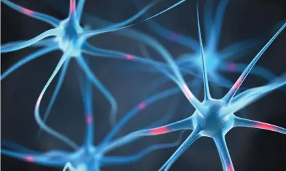  ?? Photograph: Alamy StockPhoto ?? Neurons in the brain. Rather than implanting directly into the brain, the bionic neurons are built into ultra-low power microchips that form the basis for devices that would plug straight into the nervous system.