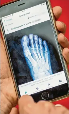  ?? Foto: Michael Kappeler, dpa ?? Ein Röntgenbil­d eines Fußes, angezeigt mithilfe der neuen digitalen Gesundheit­sapp mit dem Namen „Vivy“.
