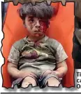  ??  ?? TinyTi casualty: A bloodied toddler is carriedca to safety yesterday. Left, OmranOm Daqneesh last week