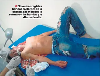  ?? FOTO: EL DIARIO ?? El hombre registra heridas cortantes en la cabeza. Los médicos le suturaron las heridas y le dieron de alta.