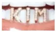  ?? ?? Plenty of lip: Kim Kardashian loves a lip cuff, not to mention an array of dental diamante