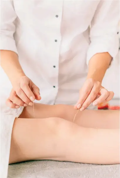  ?? ?? TRY acupunctur­e.
