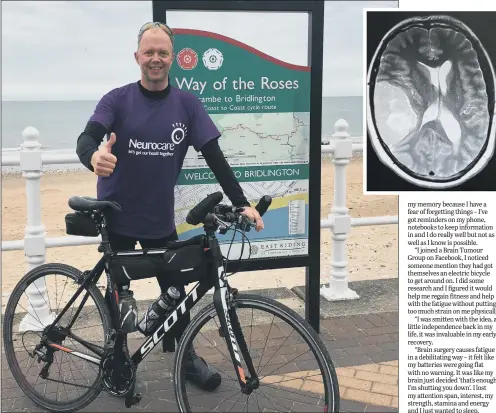  ??  ?? CHALLENGE: Chris Bexon during his 170-mile Coast to Coast cycle ride for charity; inset, surgeons removed a three-inch tumour from his brain.