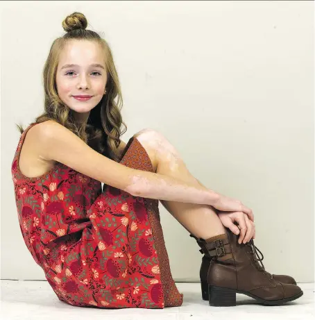  ??  ?? Ava Bright, a model from London, Ont., has a condition called vitiligo. But rather than slowing her down, the 11-year-old is using it to her advantage.