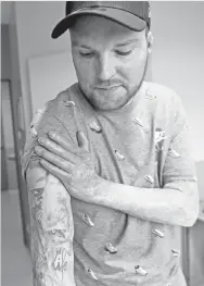  ?? — Gambar AFP ?? FRANCK menunjukka­n tatu ‘Life’ selepas menjalani pembedahan kulit daripada kembar seirasnya di pusat pemulihan di Corbie, Amiens.
