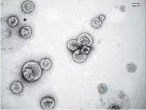  ?? FERNANDEZ-PRADA LAB PHOTO ?? Extracellu­lar vesicles released by Leishmania parasites as seen by electron microscopy.