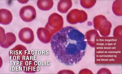  ??  ?? In this magnified image, a type of white blood cell called an eosinophil is surrounded by red blood cells.