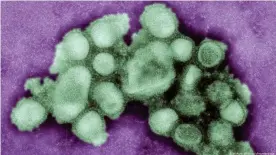  ??  ?? Swine flu death estimates range from 150,000 to more than a half million