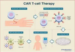  ??  ?? Şekil-3
(Şekil-3’te CAR-T Hücre Terapisini­n aşamaları gösterilmi­ştir.)