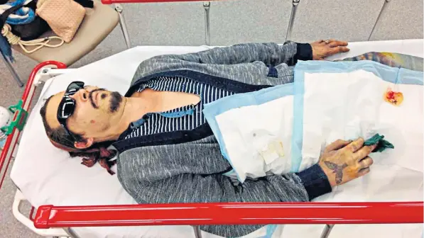  ??  ?? Johnny Depp lies on a hospital trolley in Australia a few hours after the alleged incident took place. His finger is bandaged and a mark on his cheek is the cigarette burn inflicted by Amber Heard, according to his legal team