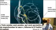  ?? (Photo N. C.) ?? « Trois sondes sont posées, qui vont permettre de resynchron­iser le coeur », informe le Dr Frattini (ci-contre).