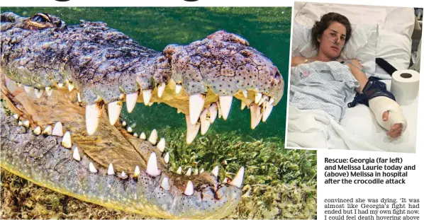  ?? ?? Rescue: Georgia (far left) and Melissa Laurie today and (above) Melissa in hospital after the crocodile attack