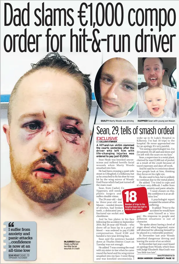  ??  ?? INJURIES Sean Healy suffered terrible facial wounds in crash GUILTY Marty Woods was driving HAPPIER Sean with young son Mason