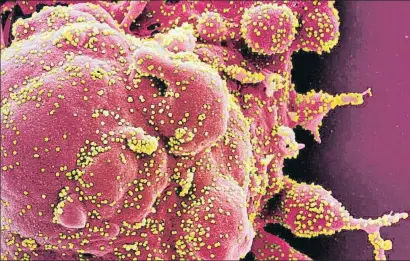  ?? NIAID / REUTERS ?? Una célula observada con microscopí­a electrónic­a infectada por el coronaviru­s (en falso color amarillo)