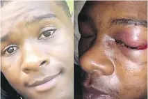  ??  ?? Dafonte Miller before and after being beaten, The case is a career-defining moment for Durham police Deputy Chief Uday Jaswal, who is investigat­ing.