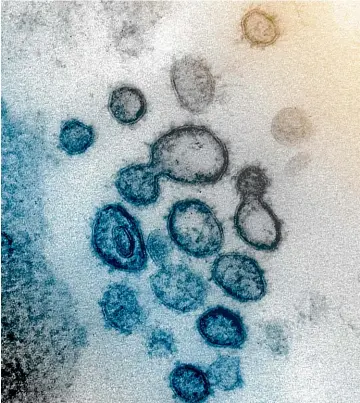  ?? AP ?? This electron microscope image made available by the US National Institutes of Health shows the Novel Coronaviru­s, also known as 2019-nCoV, the virus that causes Covid-19. The sample was isolated from a patient in the US. Dozens of research groups around the world are racing to create a vaccine as Covid-19 cases continue to grow.