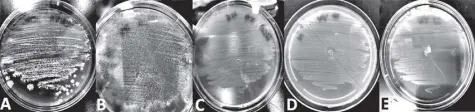  ?? Photo from Philippine Journal of Science ?? Observable traits of streptomyc­es sp. a1-08 are on different media on petri dishes.