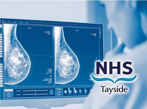  ?? ?? SCANDAL: Breast cancer treatment on Tayside is in turmoil amid discontent among senior medical staff.