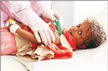  ??  ?? A Yemeni child suspected of being infected with cholera is checked by a doctor at a makeshift hospital operated by Doctors Without Borders (MSF) in the northern district of Abs Yemen’s Hajjah province on July 16. The country has
also killed more than...