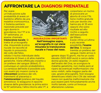  ??  ?? MISURAZION­I IMPORTANTI Nell’immagine sopra, un’ecografia in cui viene misurata la translucen­za nucale e l’osso del naso.