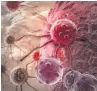  ??  ?? RISK Deadly cancer cells