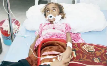  ??  ?? طفلة يمنية تعاني من سوء التغذية تتلقى العالج في مستشفى بالحديدة أخيرا. (أ. ف. ب)