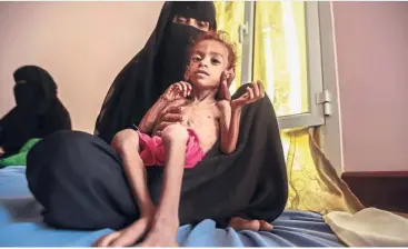  ??  ?? In dire need of food: Over seven million children in Yemen face food insecurity.