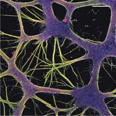  ?? COURTESY STEM PHARM ?? This network of neurons formed on a Stem Pharm hydrogel. The green stain shows neural fibers; the blue stain shows the nucleus of each neuron.