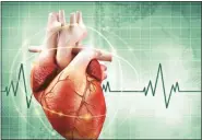  ?? ?? Individual­s with an irregular heartbeat, also known as arrhythmia, may experience a common condition known as atrial fibrillati­on.