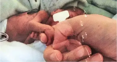  ??  ?? Holding on tight: Flynn, barely bigger than his mother’s hand, clutches her finger