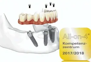  ??  ?? Die Praxiszahn­klinik Günzburg ist seit dem 1. August 2016 zeritifizi­ertes All on 4® Kompetenzz­entrum.