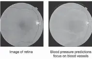  ??  ?? The image on the right shows how the algorithm picks out vessels to predict blood pressure. GOOGLE