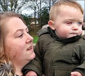  ??  ?? Oscar Webb with his mother Amy: He will eventually be fitted with a prosthetic eye