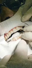  ?? R. VILALLONGA / ARCHIVO ?? Intervenci­ón de blanqueami­ento en una clínica dental
de Barcelona