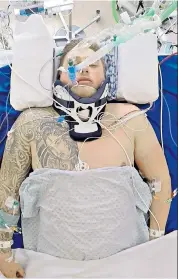  ??  ?? Intensive care: Taylor Britton broke his neck in a car accident