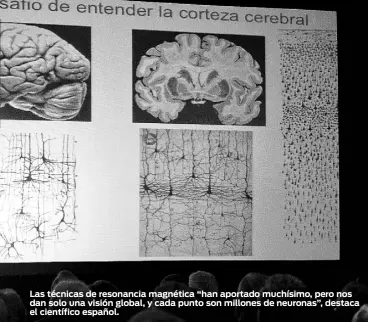  ??  ?? Las técnicas de resonancia magnética “han aportado muchísimo, pero nos dan solo una visión global, y cada punto son millones de neuronas”, destaca el científico español.