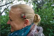  ?? BENNETT CONTRIBUTE­D/PAMELA ?? Amy Stone has a spotted lanternfly on her hair.