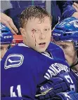  ?? MARK VAN MANEN/PNG ?? Blood drips from Vancouver Canucks forward Ronalds Kenins’ face on Tuesday at Rogers Arena.